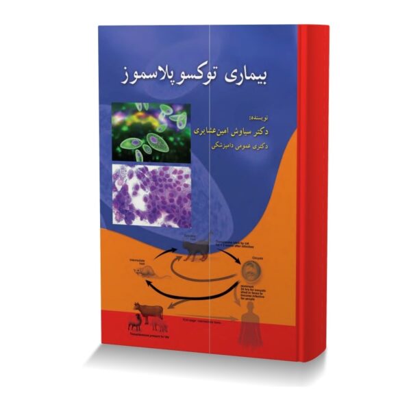 بیماری  توکسوپلاسموز